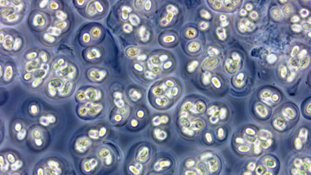 Close up of Gloeocapsa magma