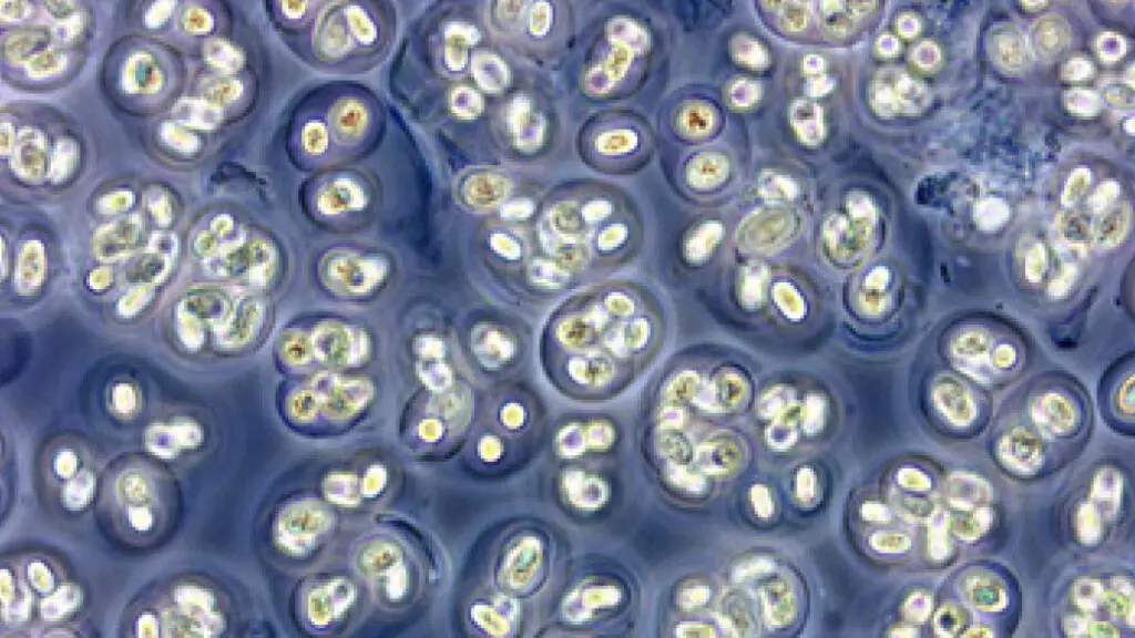 Close up of Gloeocapsa magma